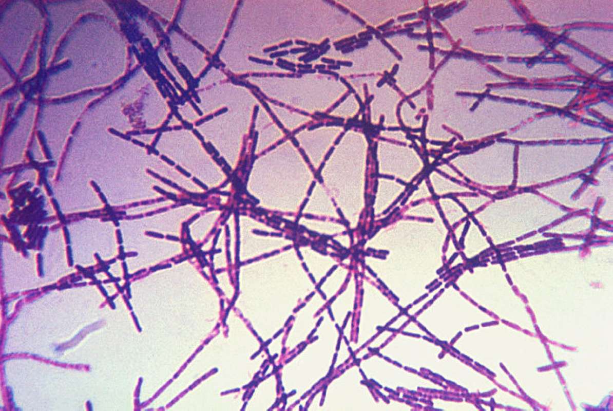 Gram-stain<br>(Origin of the Specimen: CDC Image)
