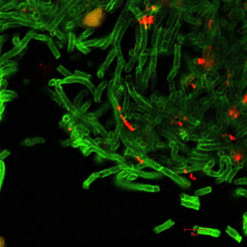 Confocal Micrograph