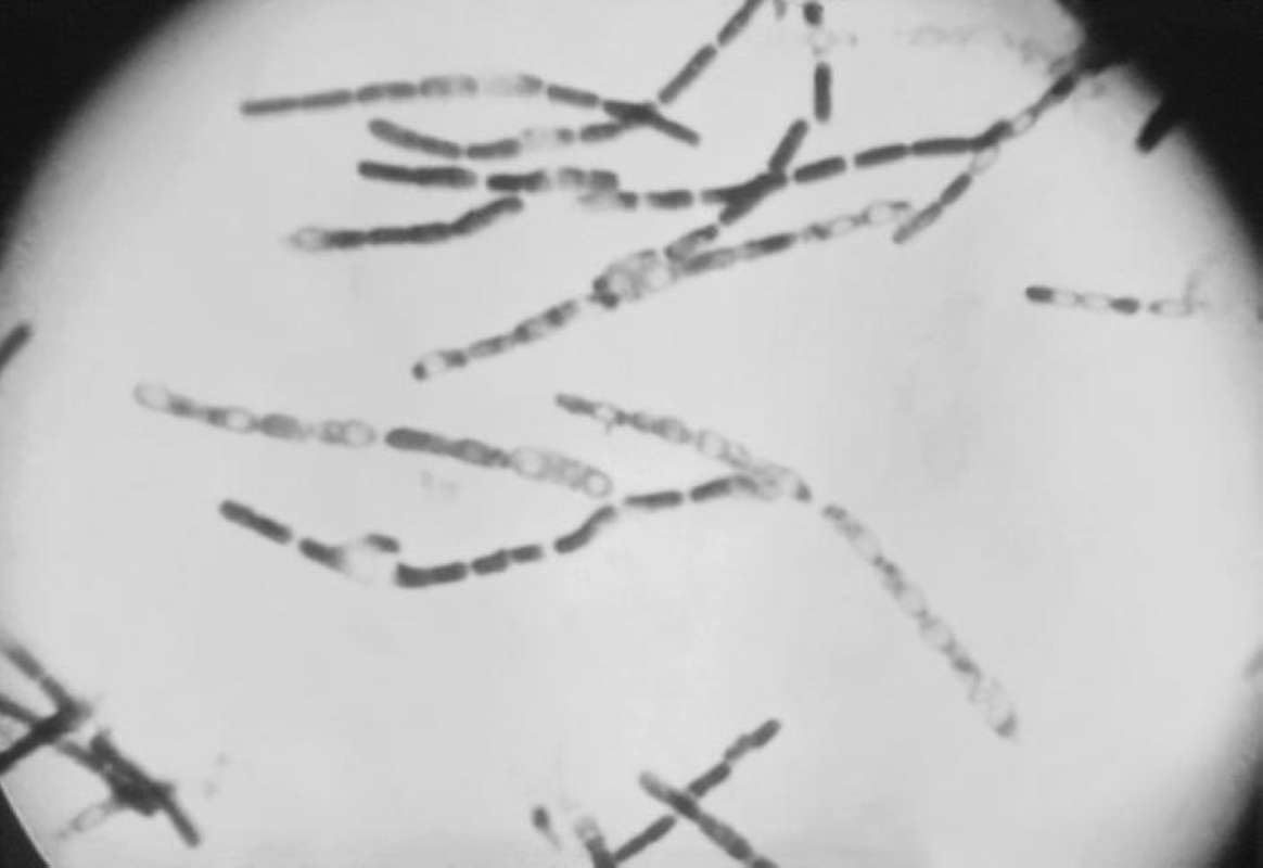 Endospore Forming