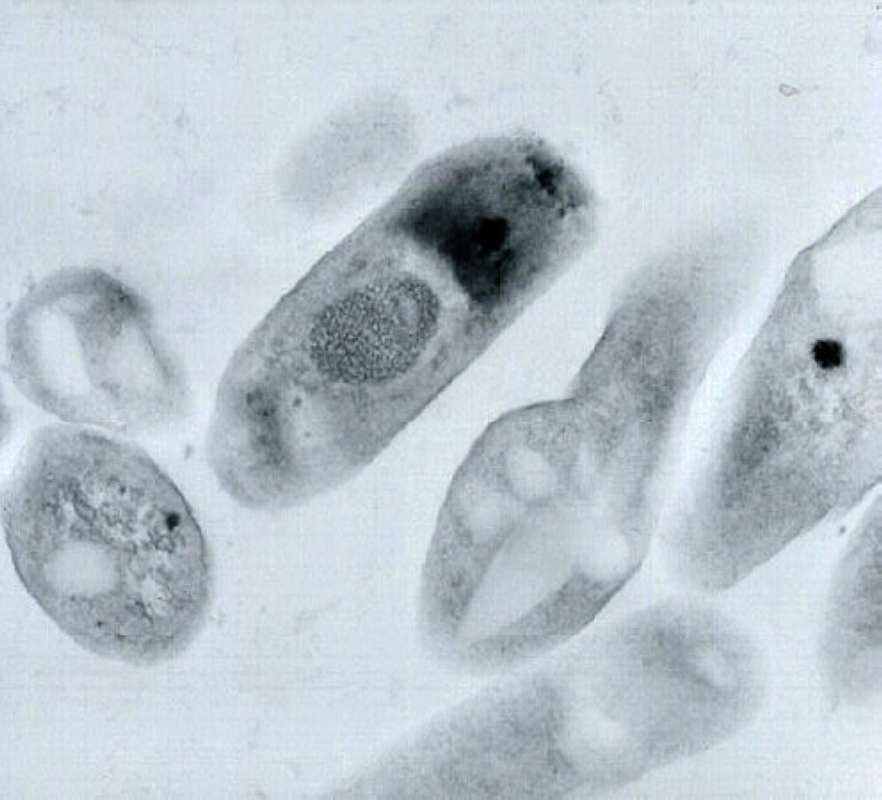 Electron Micrograph