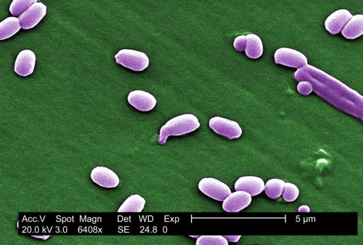 6,408 X Magnification