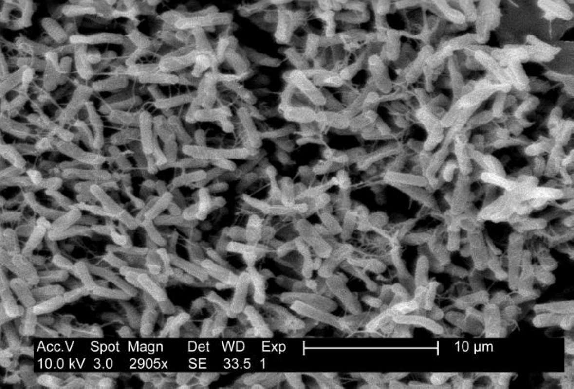 2,905 X Magnification<br>(Origin of the Specimen: CDC Image)