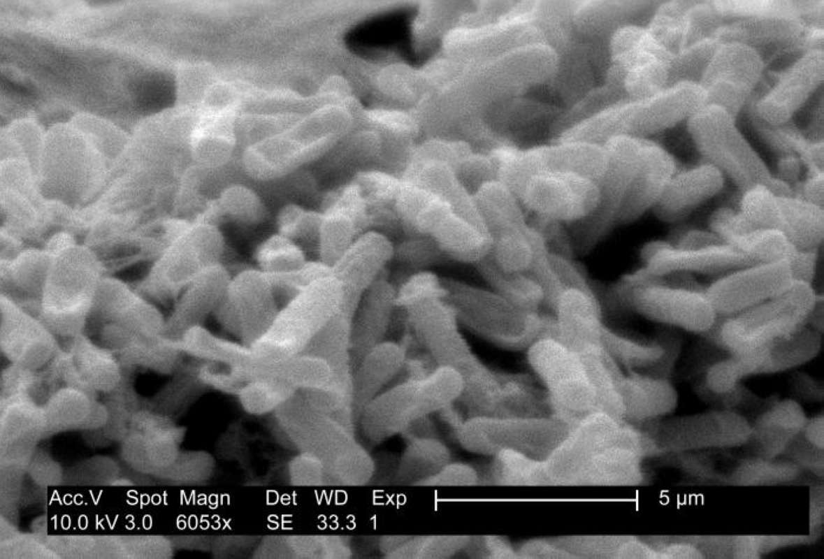 6,0553 Magnification<br>(Origin of the Specimen: CDC Image)